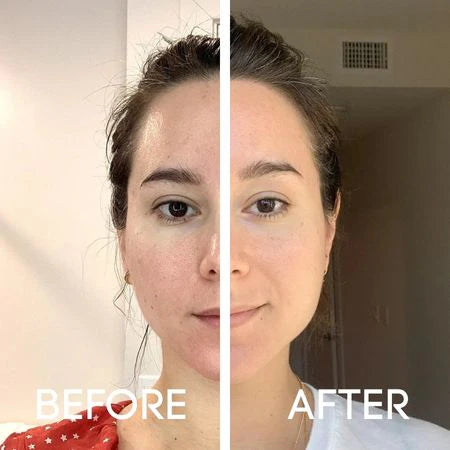 DermaShot Duo – Smooth & Glow Instantly
